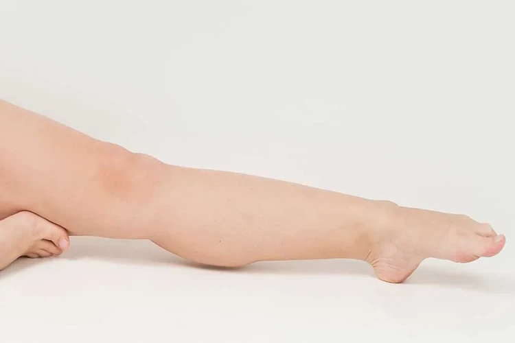 Bacak Deformiteleri: Nedenleri, Tanı ve Tedavi Yaklaşımları