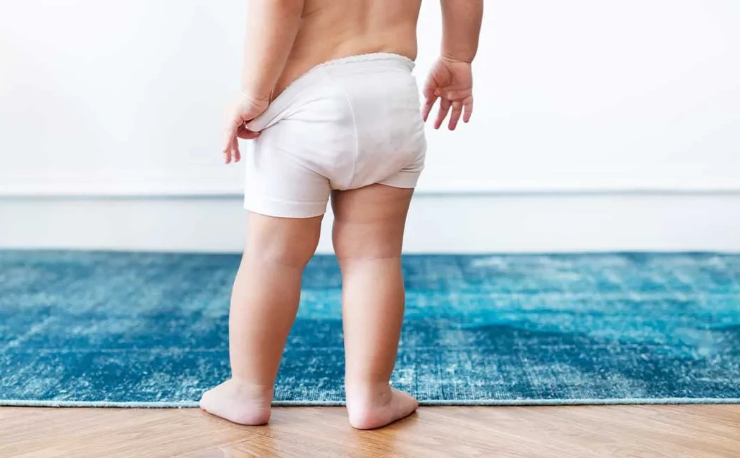 Çocuklarda Kalça Çıkığı ve Güncel Tedavi Yöntemleri