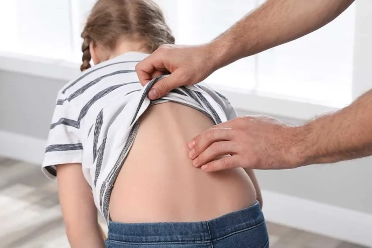 Çocuklarda Skolyoz (Omurga Eğriliği) Tedavi Yöntemleri