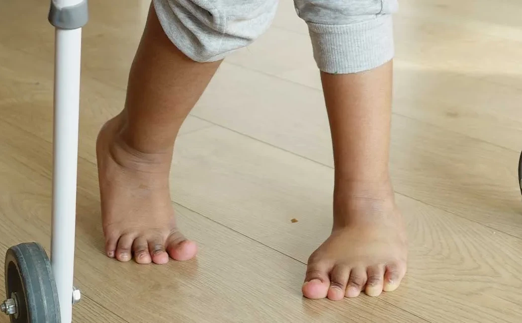 Çocukluk Çağı Ender Görülen Deformiteleri: Kapsamlı Rehber