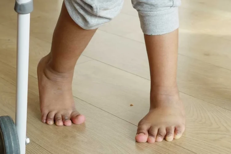 Çocukluk Çağı Ender Görülen Deformiteleri: Kapsamlı Rehber