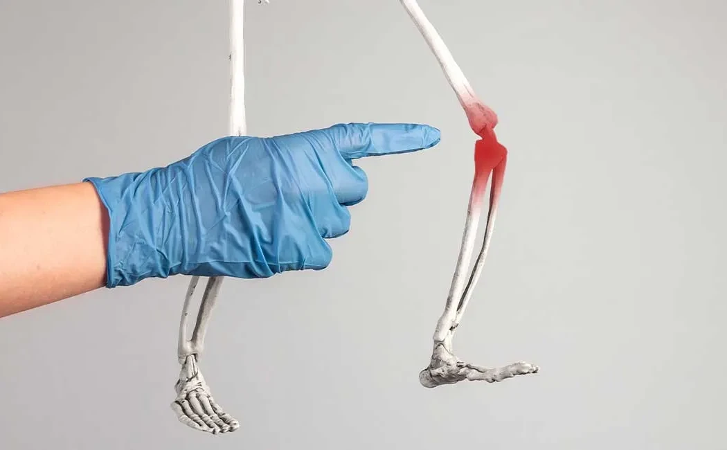 Deformite Cerrahisi: Kemik Eğrilikleri ve Tedavi Yöntemleri