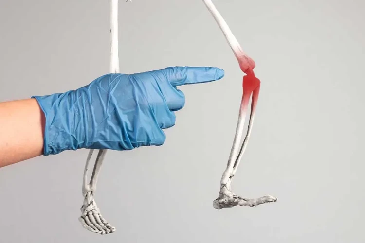 Deformite Cerrahisi: Kemik Eğrilikleri ve Tedavi Yöntemleri