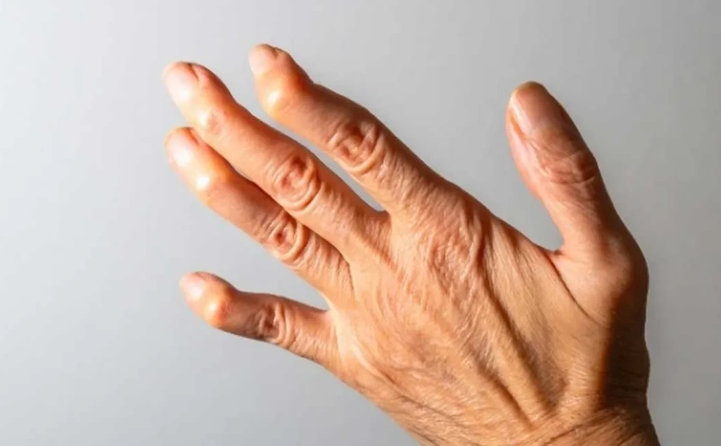 Deformite Cerrahisinde 3D Planlama ve Kişiye Özel Çözümler