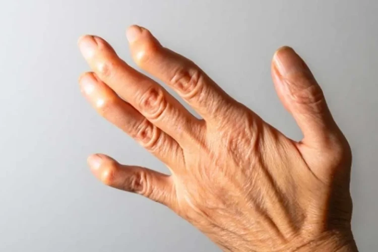 Deformite Cerrahisinde 3D Planlama ve Kişiye Özel Çözümler