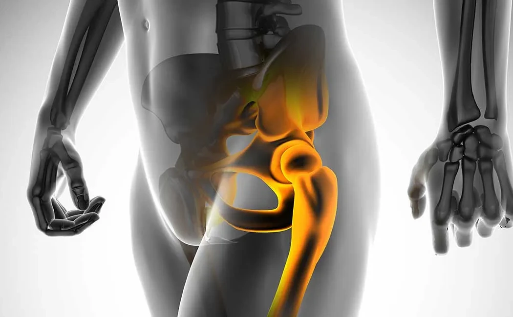 Eklem Koruyucu Tedaviler ile Kalça Protezi Ertelenebilir mi?