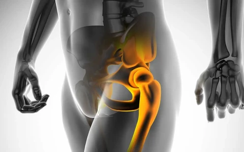 Can Joint Preservation Treatments Delay Hip Replacement Surgery?