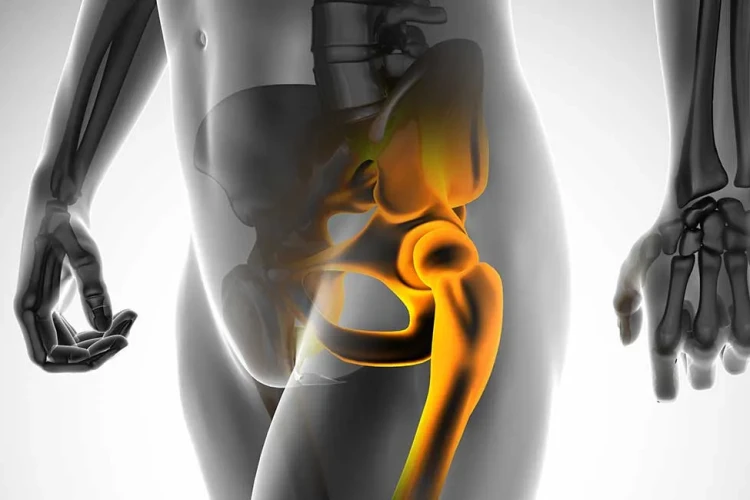 Eklem Koruyucu Tedaviler ile Kalça Protezi Ertelenebilir mi?