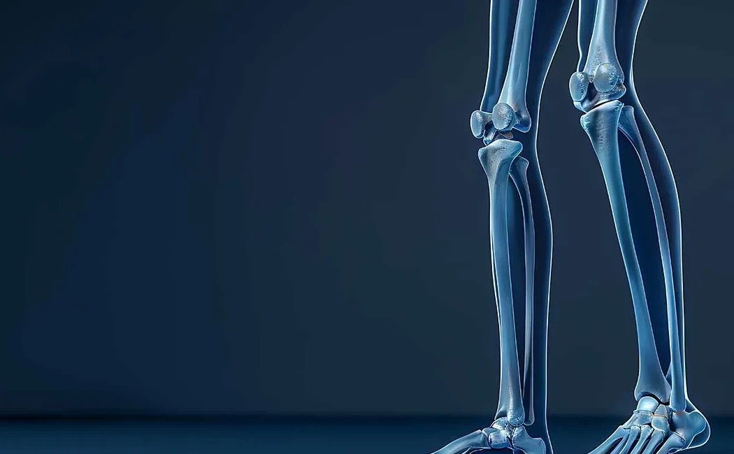 Ekstremite Uzatma Cerrahisinde En Sık Karşılaşılan Komplikasyonlar