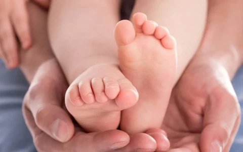 What Is Fibular Hemimelia? Diagnosis and Paley Method Treatment