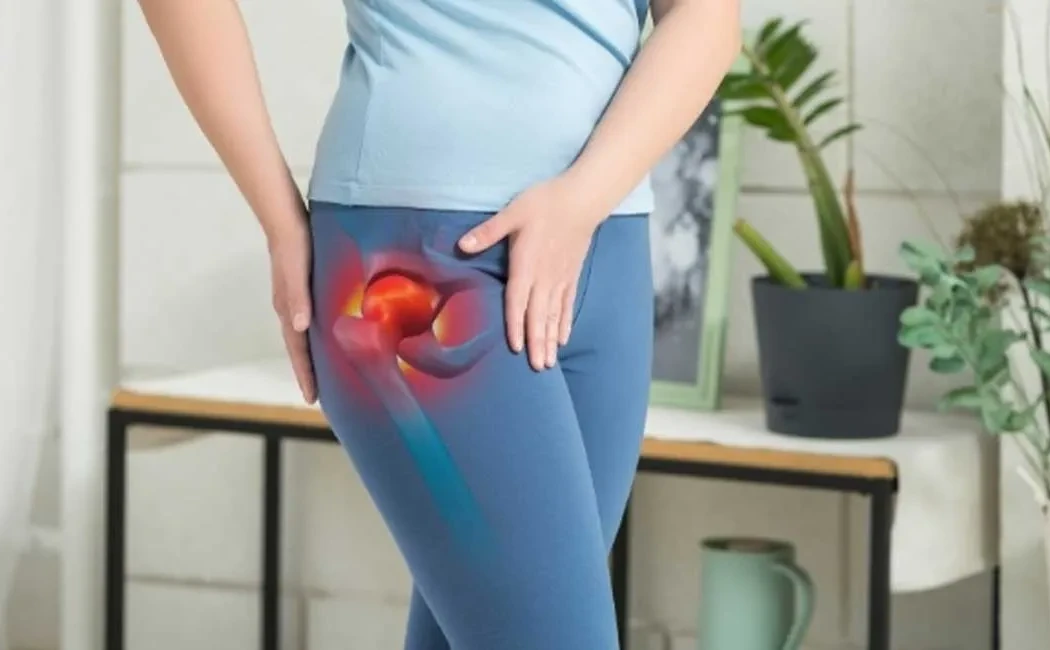 Kalça Ekleminde Sıkışma Sendromu: Erken Belirtiler ve Tedavi
