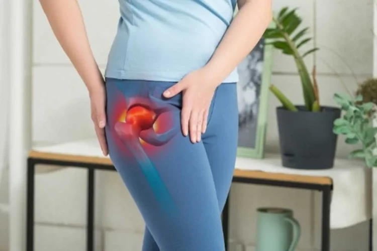 Kalça Ekleminde Sıkışma Sendromu: Erken Belirtiler ve Tedavi