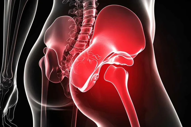 Kalça Kireçlenmesi ve Koksartroz: Protez Cerrahisi Rehberi