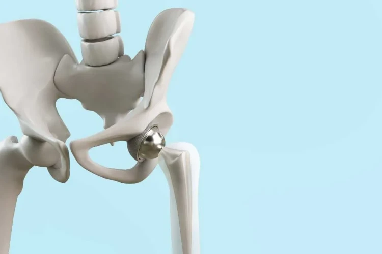 Kalça Protezinde Güncel Yaklaşımlar: Hangi Hastalara Önerilir?