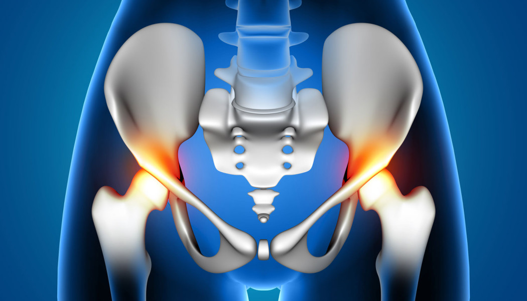 Hip Osteoarthritis: Symptoms, Treatment and the Replacement Decision