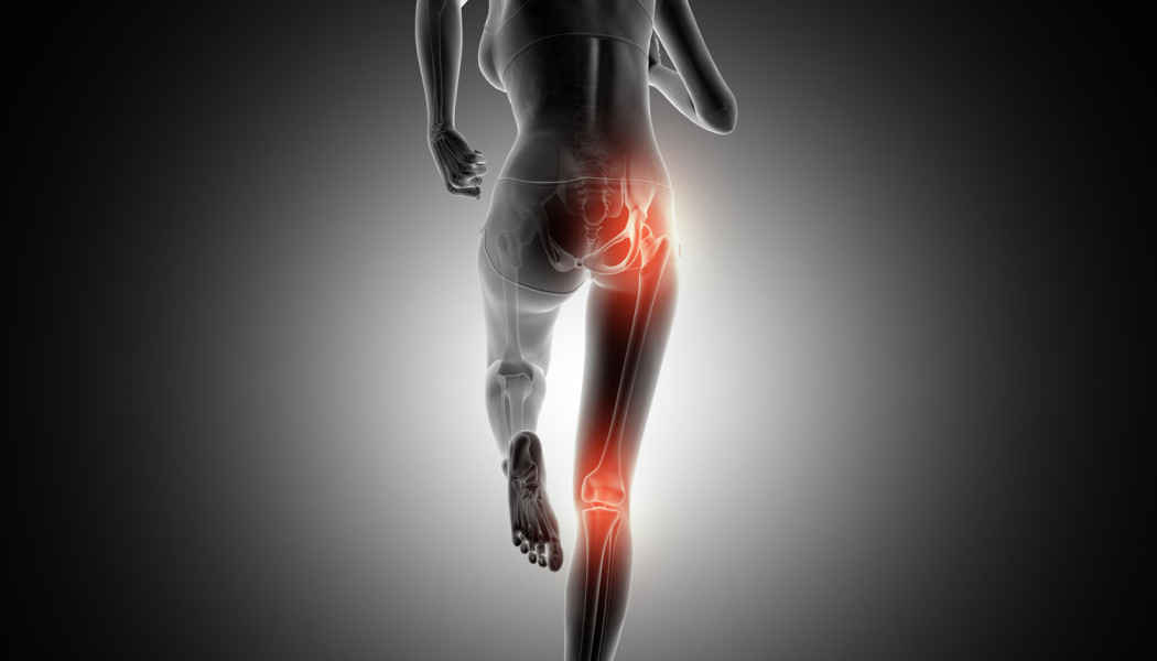 Complex and Revision Hip and Knee Replacement Surgery
