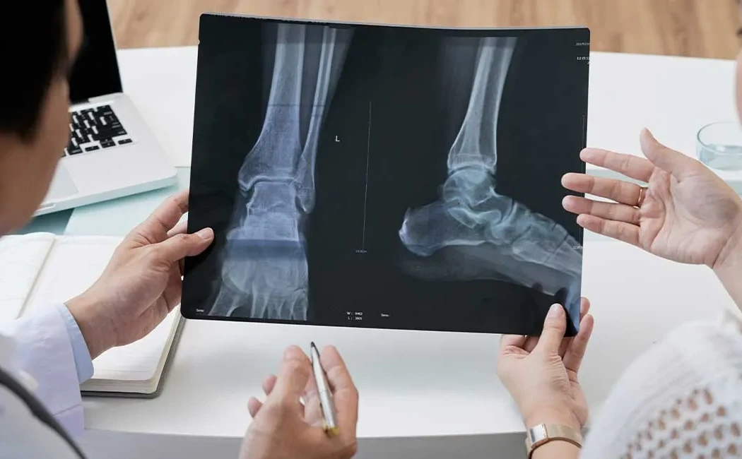 Kaynamama Cerrahisi: Kırık Tedavisinde Son Çözümler