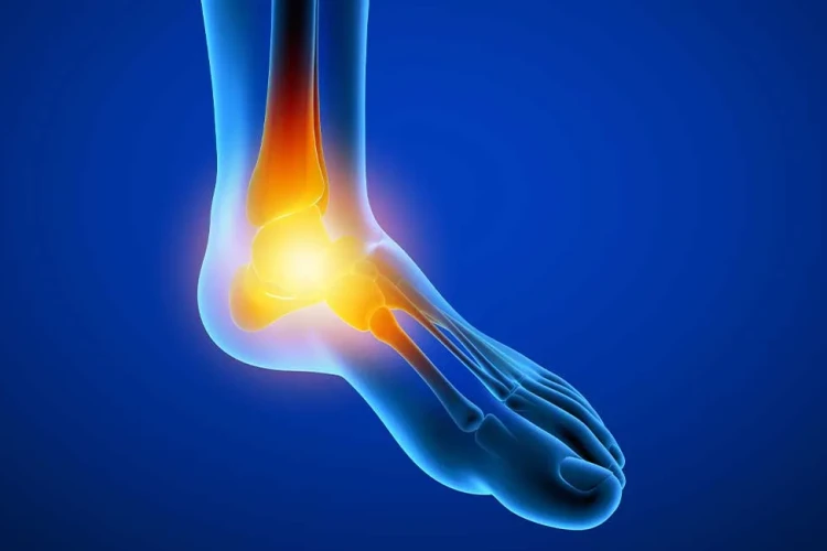 Kaynamama Cerrahisi: Tedaviler ve Yöntemler