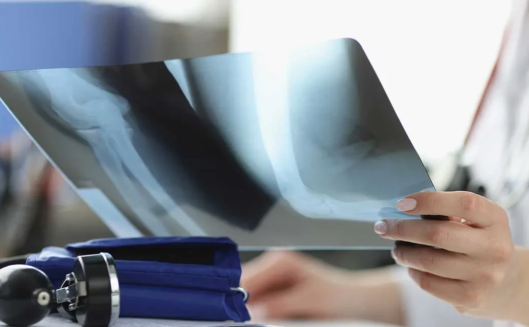 Kaynamama Cerrahisi: Zorlu Kırıkların Tedavisi ve Revizyonu