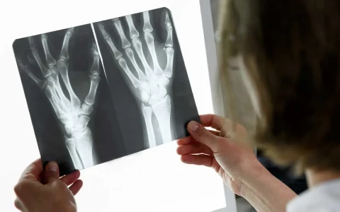Kaynamama (Nonunion) Cerrahisinde Başarıyı Artıran Faktörler