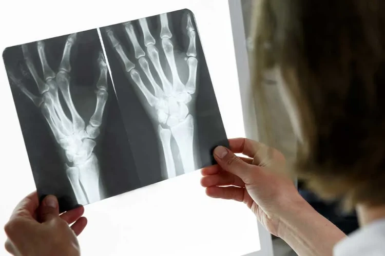 Kaynamama (Nonunion) Cerrahisinde Başarıyı Artıran Faktörler