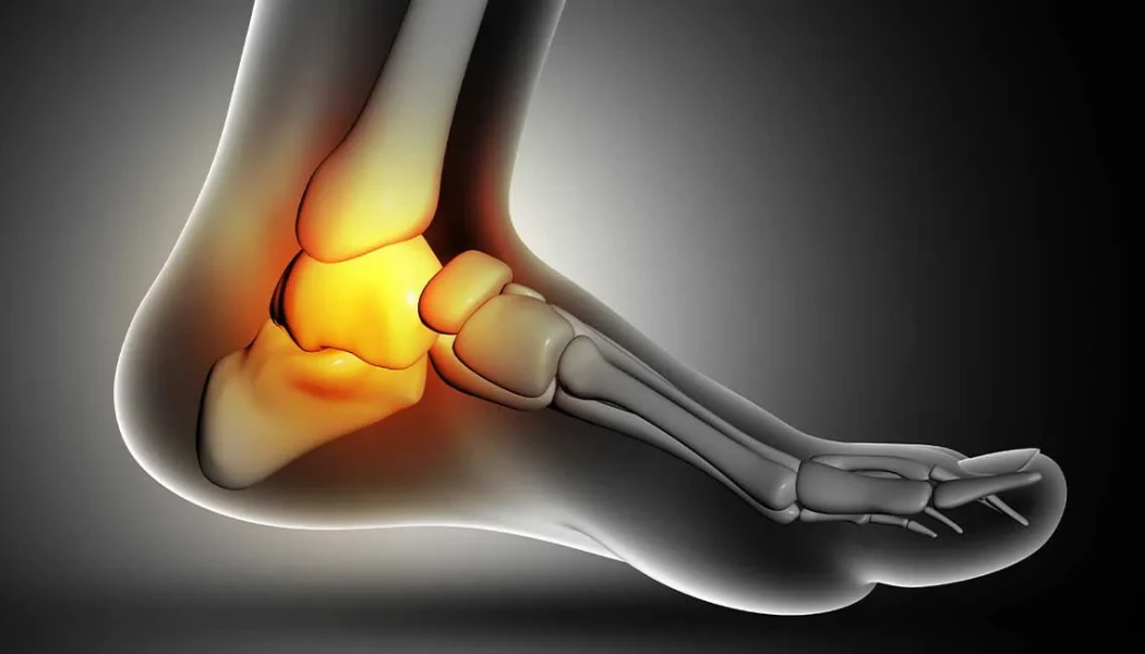 Which Bone Grafts Are Used for Nonunion Fractures?