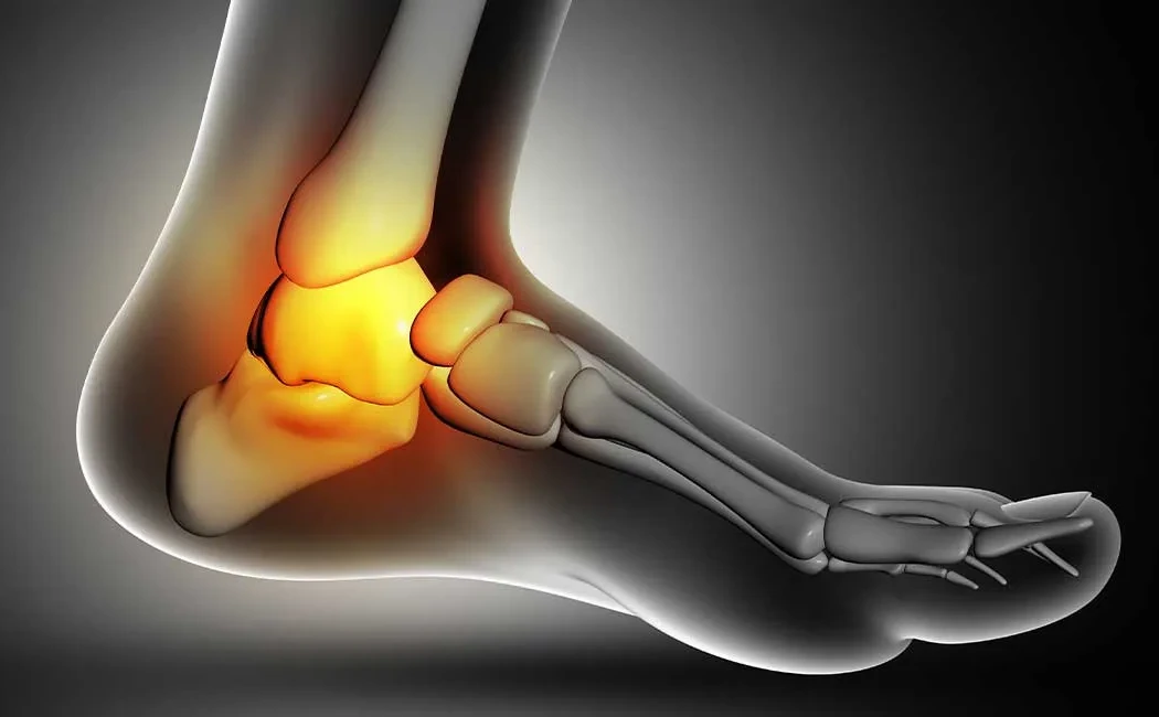 Kaynamayan Kırıklarda Hangi Kemik Greftleri Kullanılır?