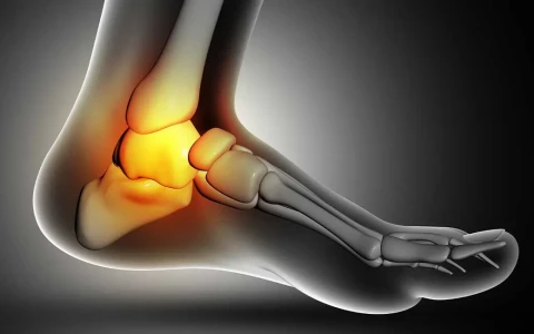Which Bone Grafts Are Used for Nonunion Fractures?