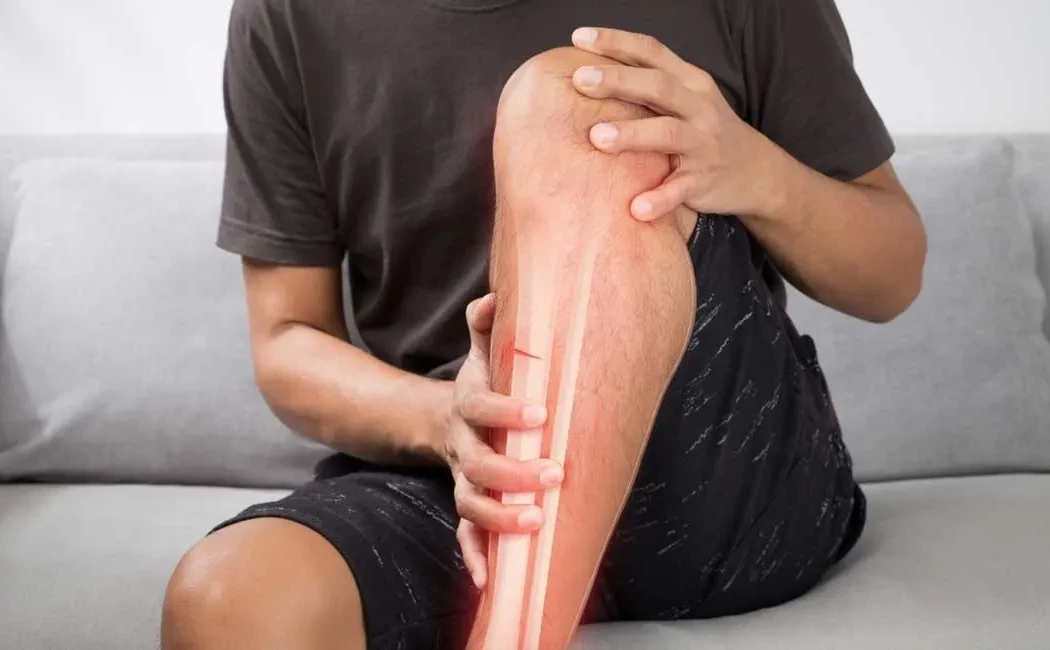 Kaynamayan Kırıklarda Kullanılan En Yeni Tedavi Yaklaşımları