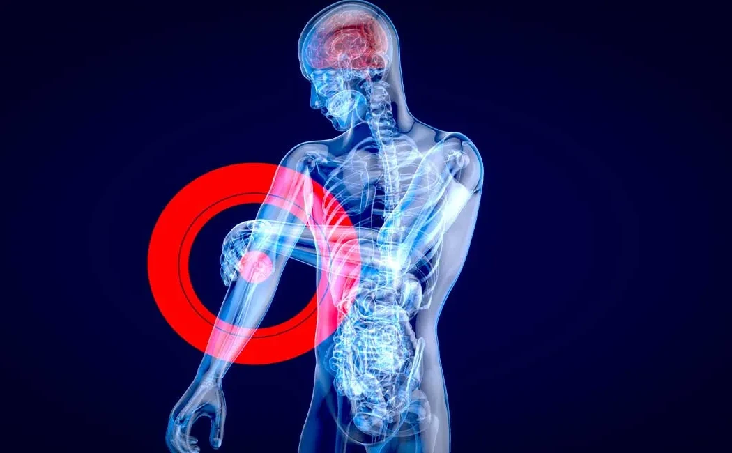 Kemik Enfeksiyonu Tedavisi: Ortopedik Yaklaşımlar