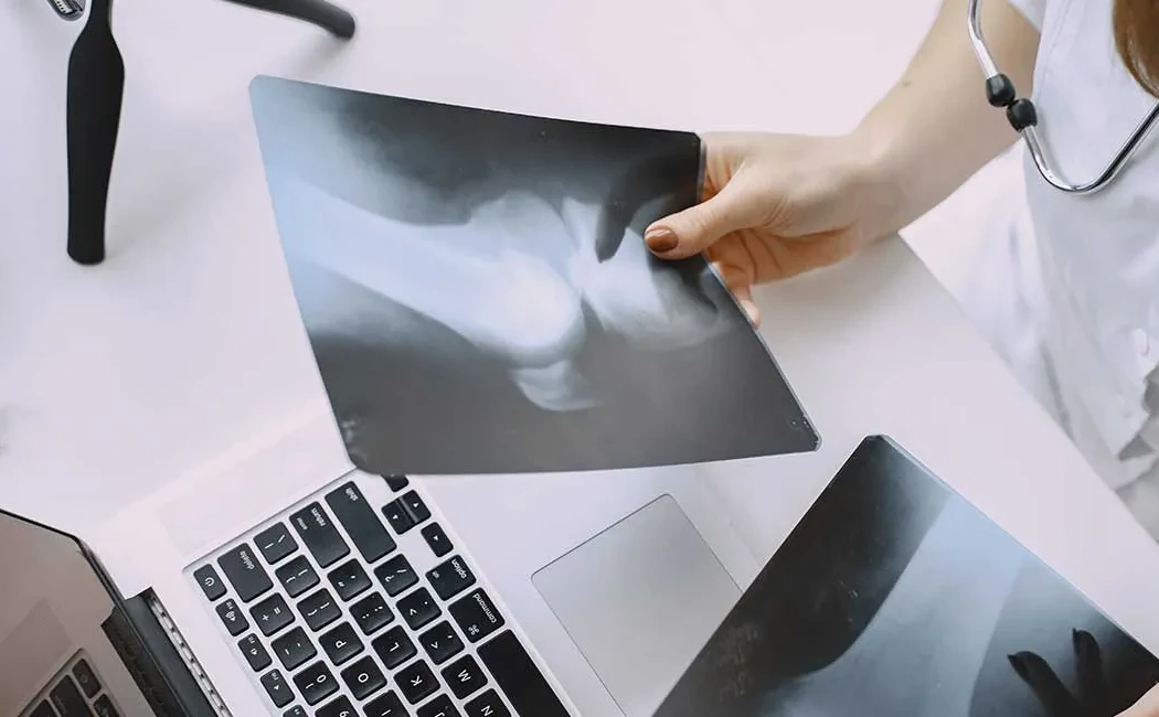 Kemik Tümörlerinde Ameliyat Sonrası Takip Süreci