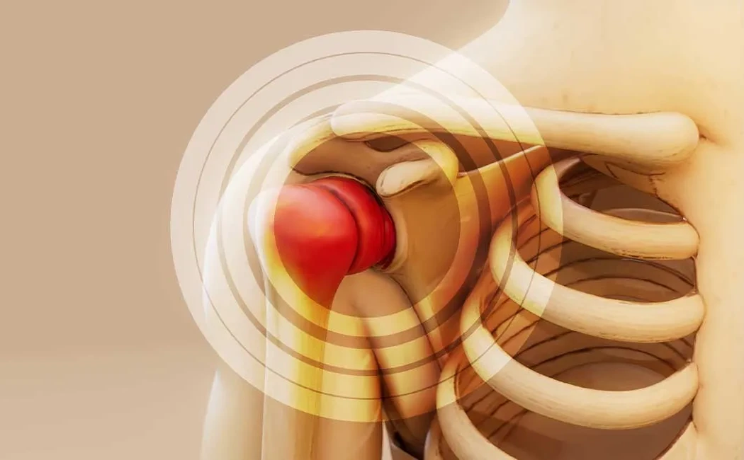 Kemik Tümörlerinde Cerrahi Rezeksiyon ve Rekonstrüksiyon Yöntemleri