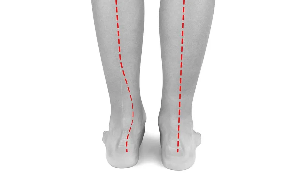 Kozmetik Boy Uzatma Ameliyatı Riskleri Nelerdir?