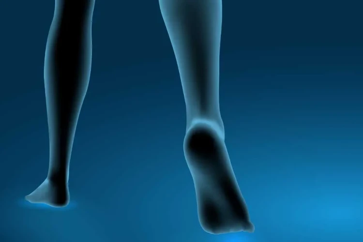 O Bacak (Parantez Bacak) Eğriliği Düzeltme Yöntemleri