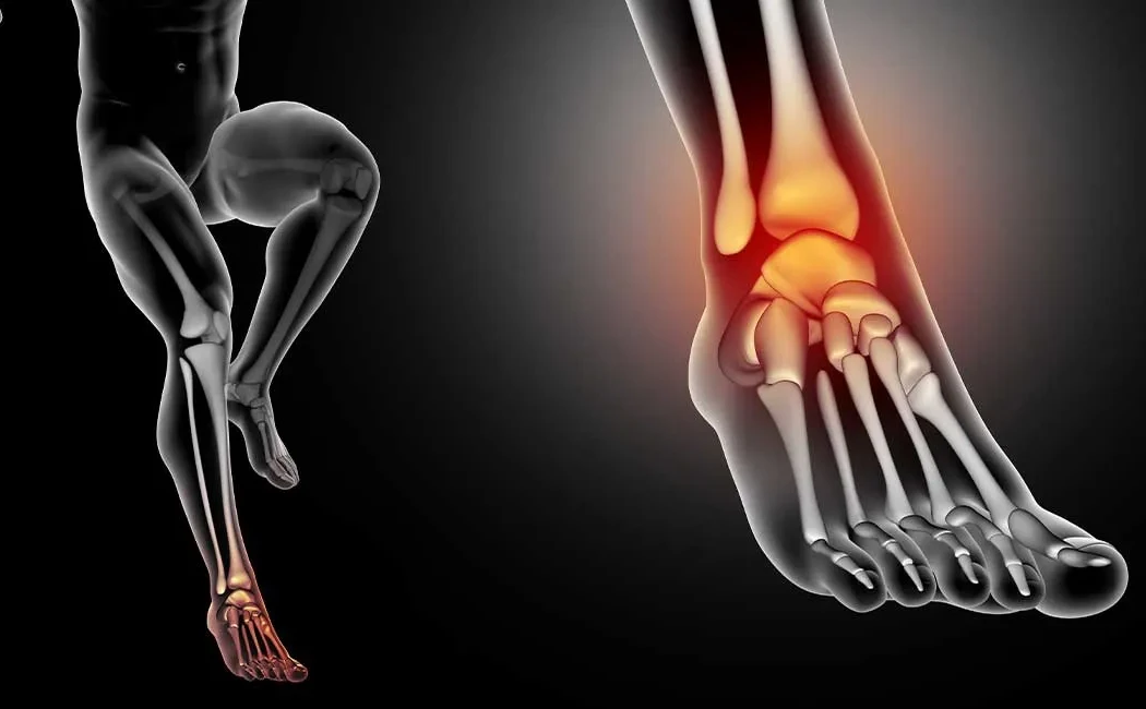 Yanlış Kaynama Cerrahisi: Başarısız Tedaviler İçin Çözümler