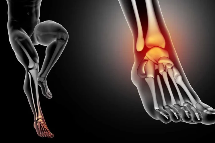 Yanlış Kaynama Cerrahisi: Başarısız Tedaviler İçin Çözümler