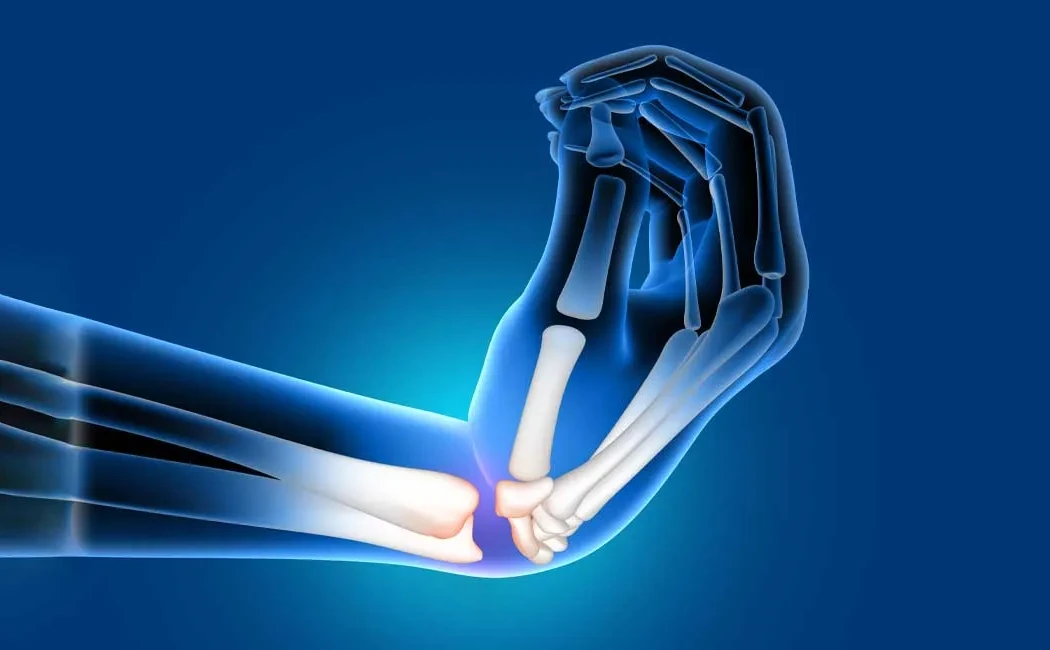 Yanlış Kaynama Cerrahisi: Başarısız Tedaviler İçin Uzman Yaklaşım