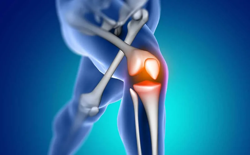 Yanlış Kaynama (Malunion) Nedir, Nasıl Tedavi Edilir?