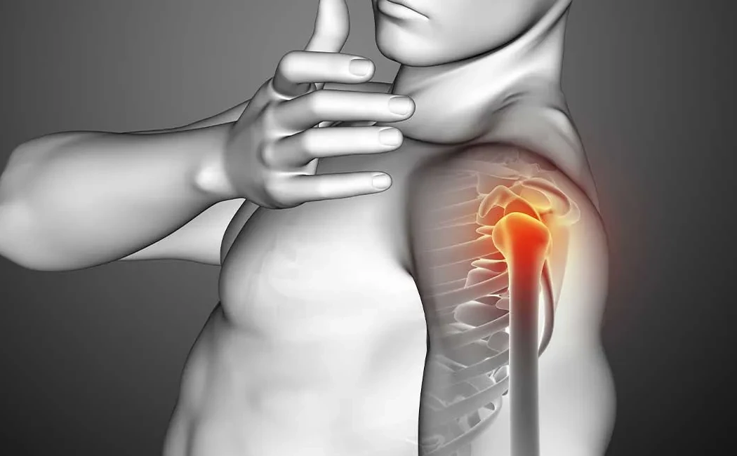 Yanlış Kaynama Tedavisi: Cerrahi ve Düzeltme Yöntemleri