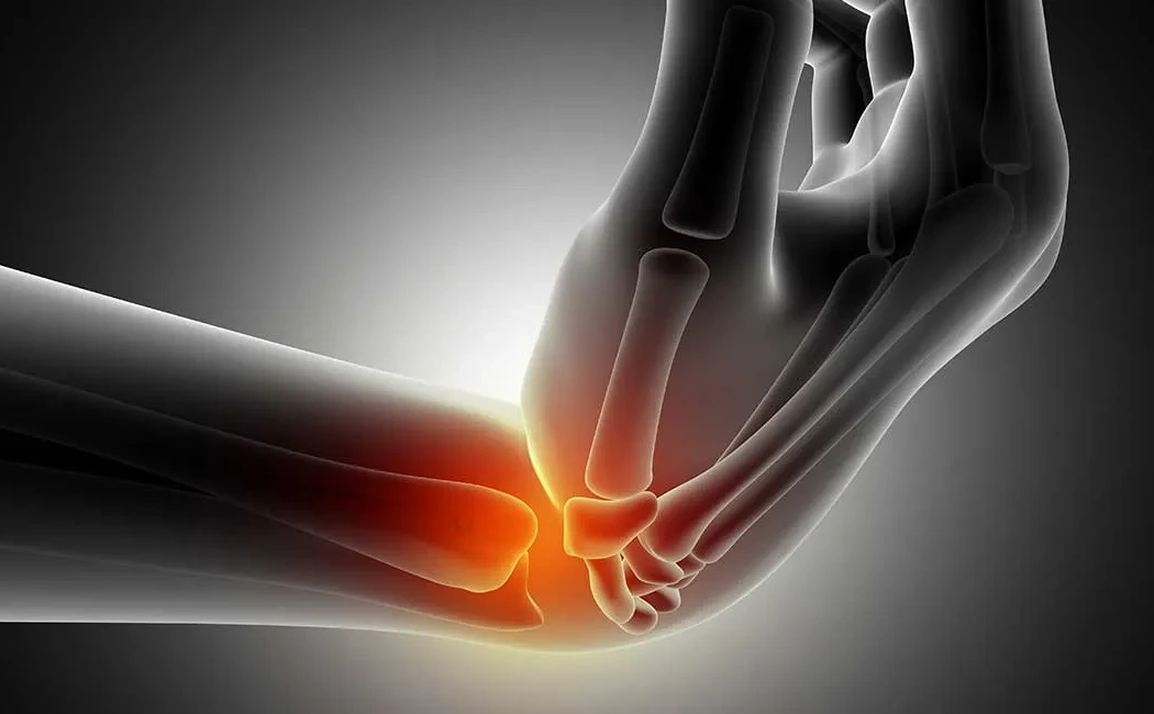 Yanlış Kaynama Tedavisi: Revizyon Cerrahisi Seçenekleri ve Çözümler