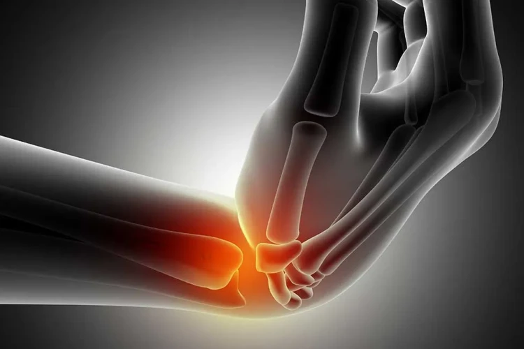 Yanlış Kaynama Tedavisi: Revizyon Cerrahisi Seçenekleri ve Çözümler